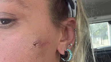 Yıldız Asyalı, Eşinden Şiddet Gördüğünü Açıkladı