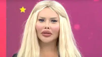 Sana Değer Pınar Kimdir? Estetik İddiaları Doğru Mu?